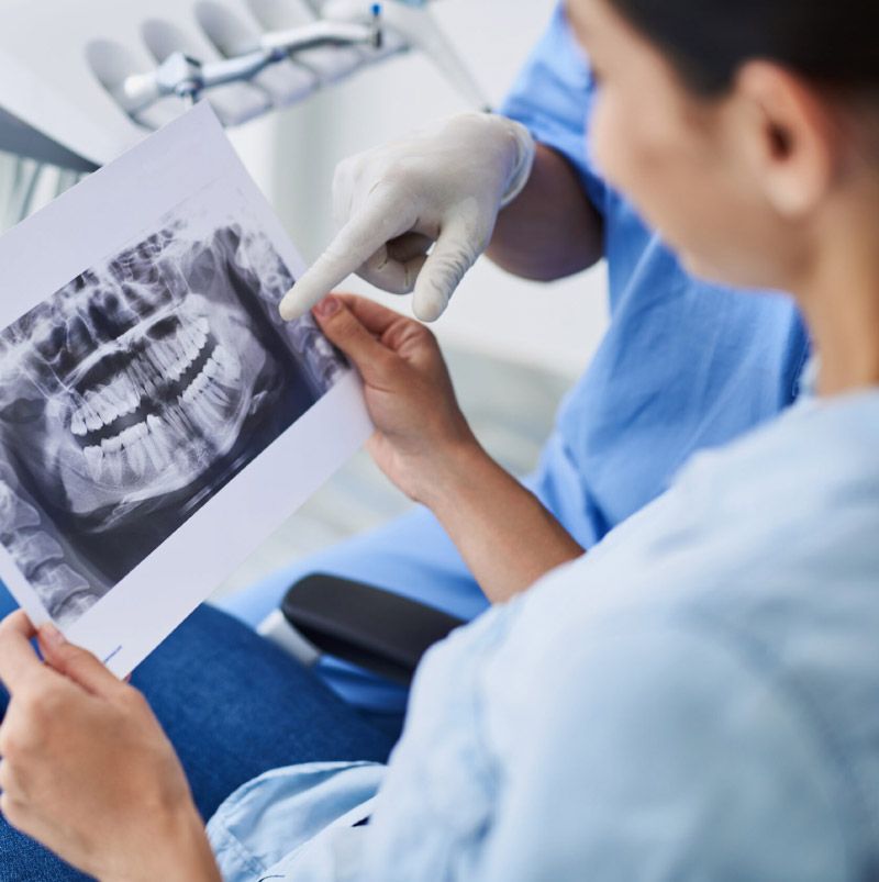 radiografía de los dientes